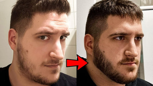 The Importance of Having a Beard: How Minoxidil and Skincare Can Transform Your Look